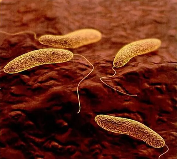 Cholera cases